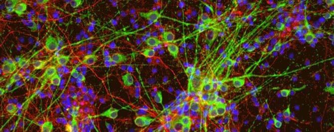 BTI-Neurones-avec texte