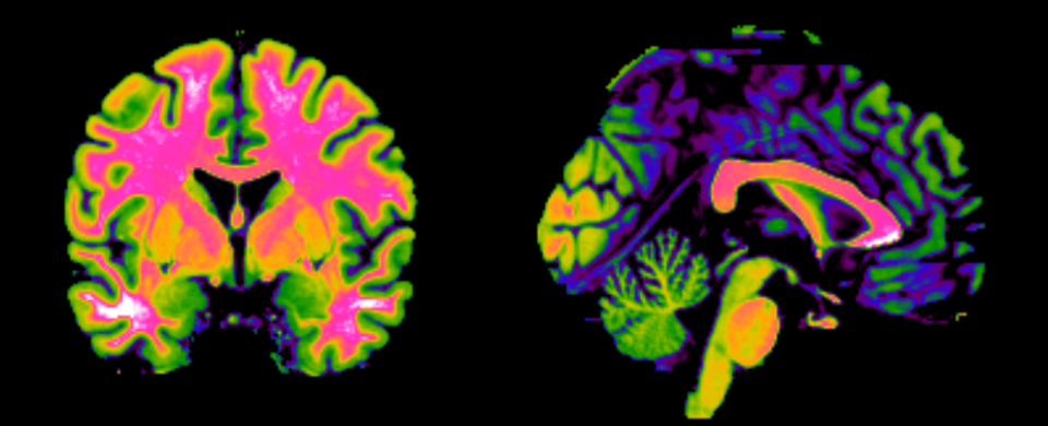 Cerveau Gret Neurosciences