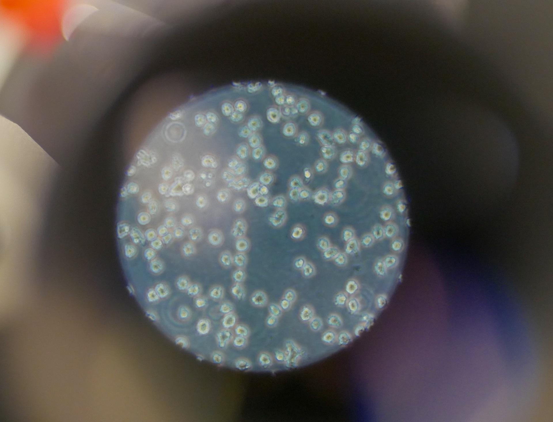 Cancer - CTM Dijon - Labo EPHE