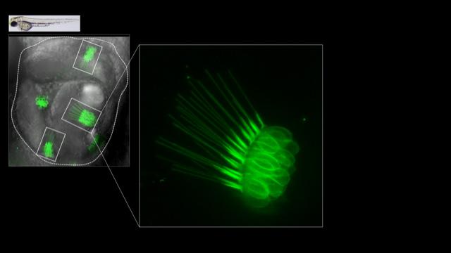 Cellules ciliées de l’oreille de larve de poisson-zèbre, marquées par la proteine fluorescente verte GFP.