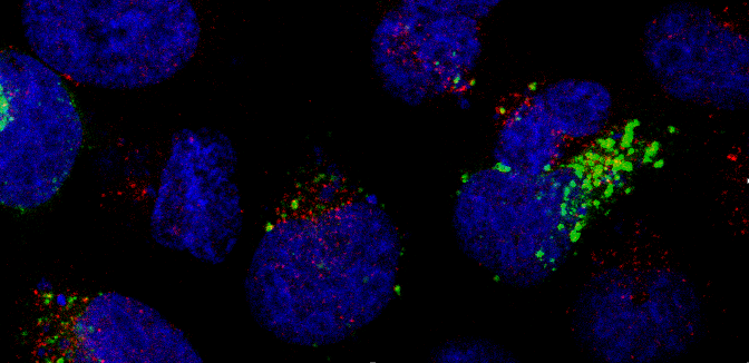 Immunofluorescence dans une lignée de cellules rénales. Les noyaux des cellules sont révélés en bleu, la protéine NBR1 porteuse de la mutation est marquée en vert, et une protéine partenaire en rouge
