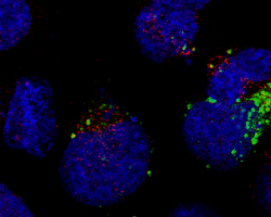 Immunofluorescence dans une lignée de cellules rénales. Les noyaux des cellules sont révélés en bleu, la protéine NBR1 porteuse de la mutation est marquée en vert, et une protéine partenaire en rouge